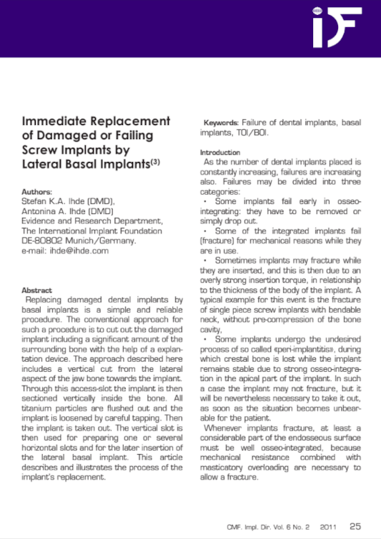 Immediate Replacement of Damaged or Failing Screw Implants by Lateral Basal Implants(3)